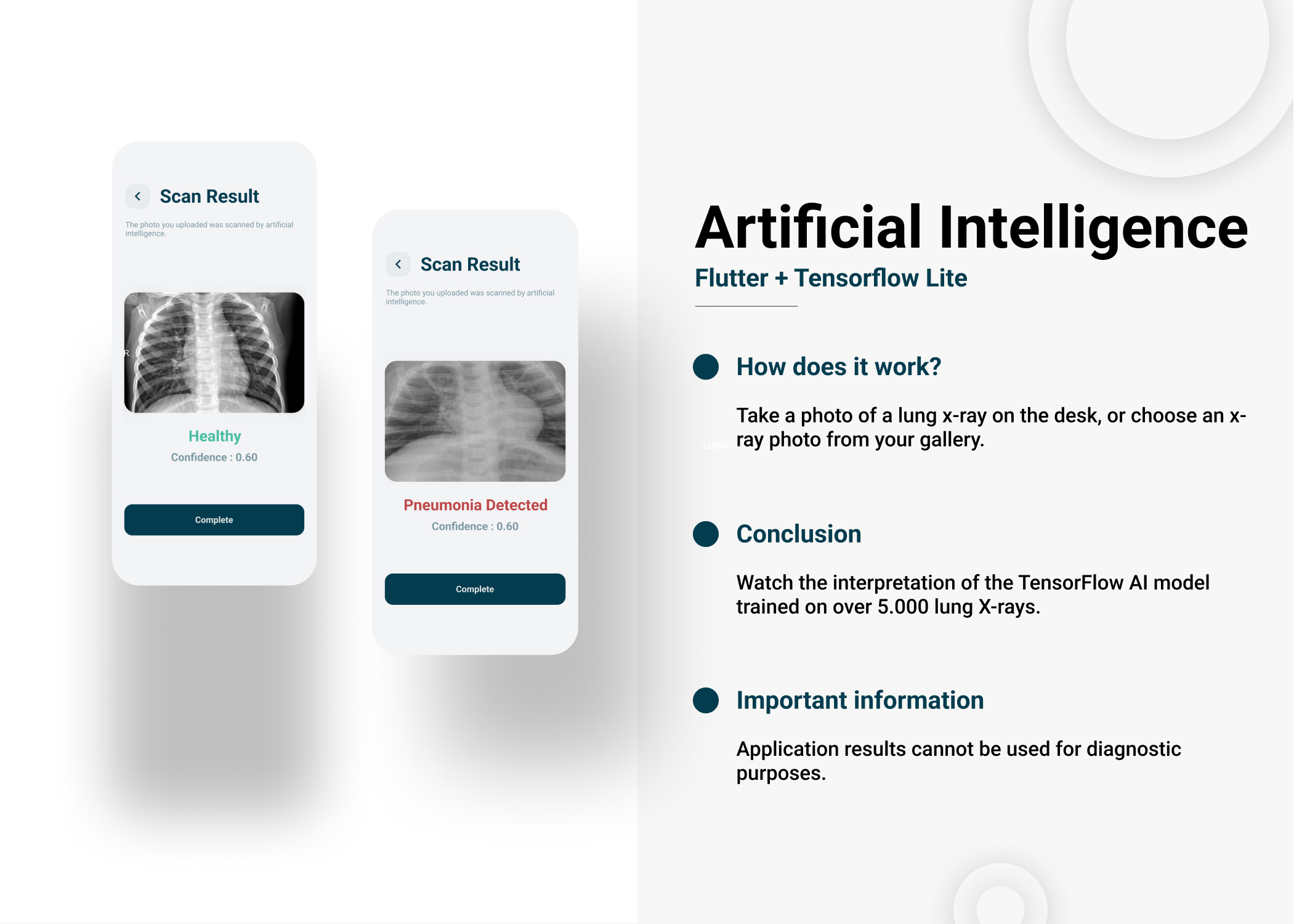 Flutter TensorFlow & Artificial Intelligence Detection of Lungs Pneumonia COVID 19 [2023 Update]