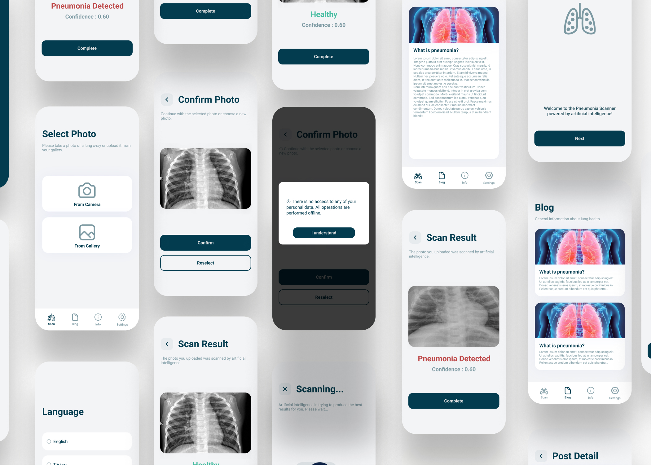 Flutter TensorFlow & Artificial Intelligence Detection of Lungs Pneumonia COVID 19 [2023 Update]
