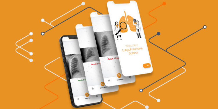 Akciğer Pnömonisinin Mobil Uygulama İle Tespiti (Google Teachable Machine + TFLite + Flutter)